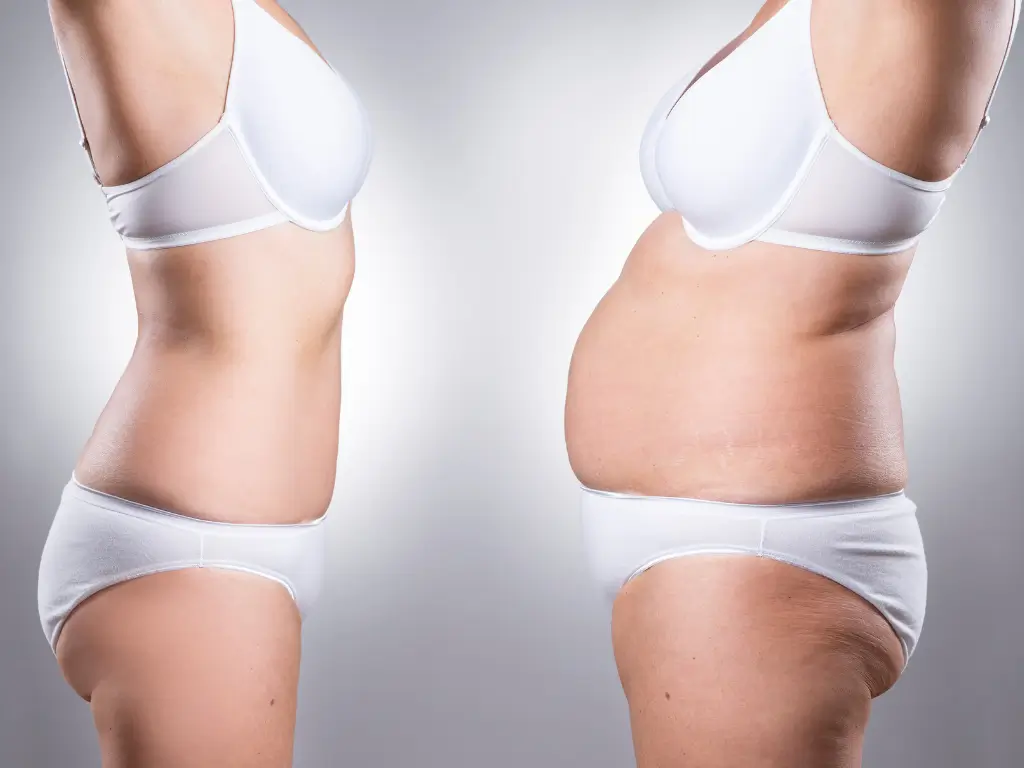 Build a Before-and-After Gallery SEO liposuction