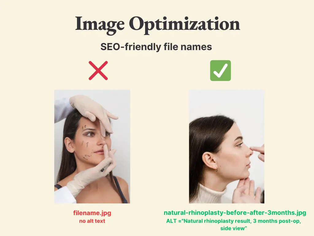 Image optimization example showing correct vs incorrect file naming and alt text usage for rhinoplasty before and after photos. Left image shows poor practice with generic filename.jpg and no alt text. Right image shows best practice with descriptive filename natural-rhinoplasty-before-after-3months.jpg and proper alt text.